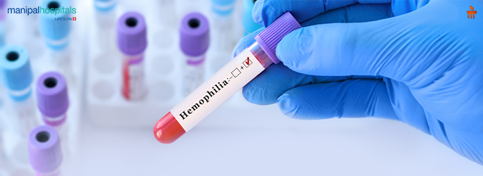 Living with Haemophilia: What Happens When the Body's Clotting System Changes?