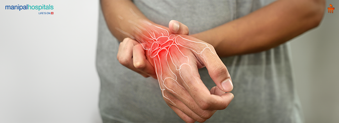 Living with Rheumatoid Arthritis: Expert Tips for Long-Term Relief