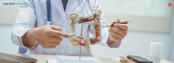 ibs treatments 2026 lasting relief