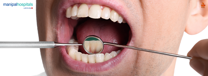 Mouth Cancer Symptoms