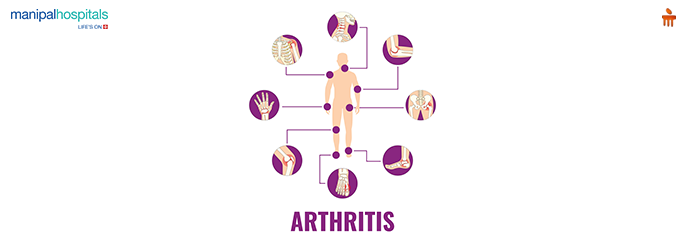 types of arthritis
