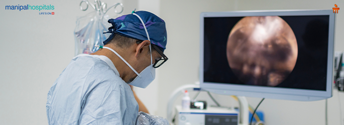POEM Procedure