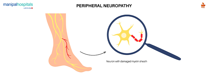 peripheral nerve injury and recovery tips