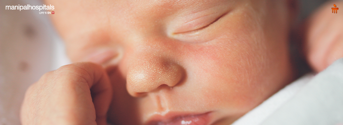 Phototherapy for Jaundice in Newborns: Risks, Benefits, and Safety Explained