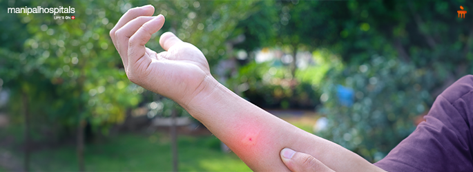Rainy Season Skin Problems in Kids: Causes and Remedies