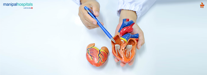 Heart bypass surgery