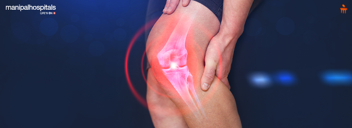 Runner's Knee Causes, Treatment and Prevention Tips