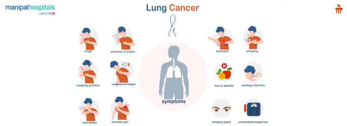 Signs of Lung Cancer