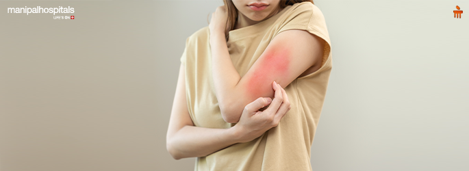 Skin allergy treatment