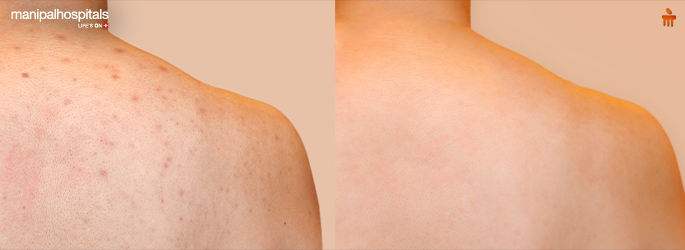 skin rash symptoms