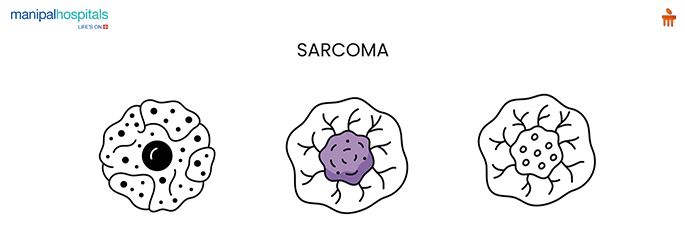 Soft tissue sarcoma