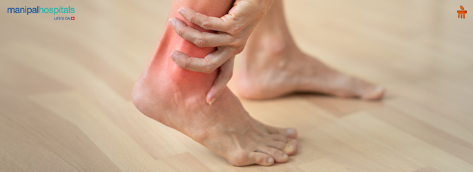 Sprained Ankle: Symptoms, Treatment Options, and How Long Recovery Takes