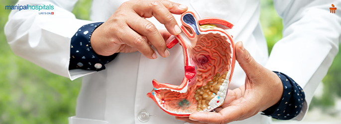 Stomach Cancer Explained: Understanding the Causes and Who Is at Risk