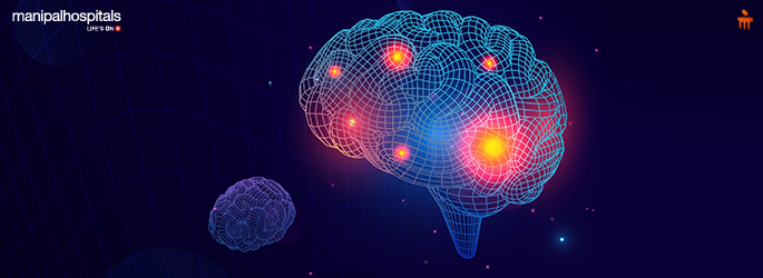stroke rehabilitation