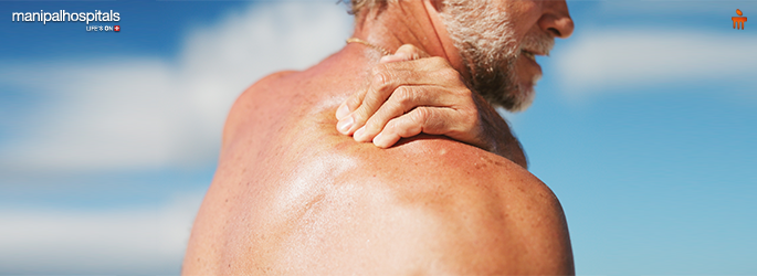 Sunburn Explained: Skin Damage, Meaning, and Natural Treatment Options Sunburn Explained: Skin Damage, Meaning, and Natural Treatment Options