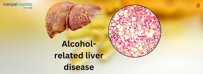 Symptoms of alcoholic liver Disease