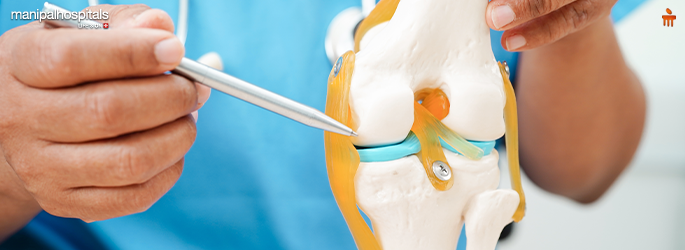 Total Knee Replacement: What to Expect Before, During, and After Surgery
