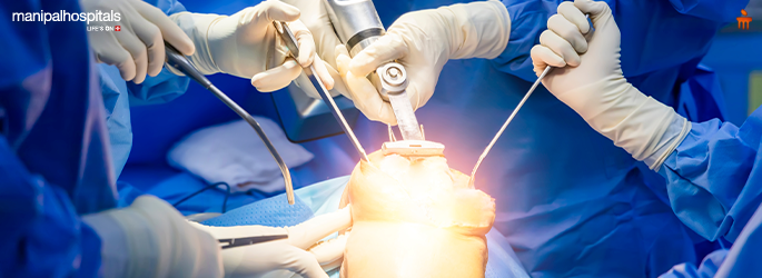 Total Knee Arthroplasty: What Indian Patients Should Know