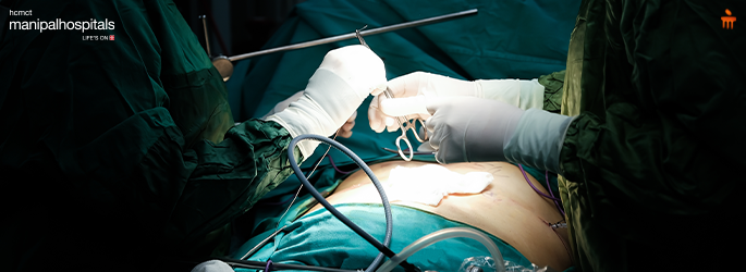 robotic bariatric surgery