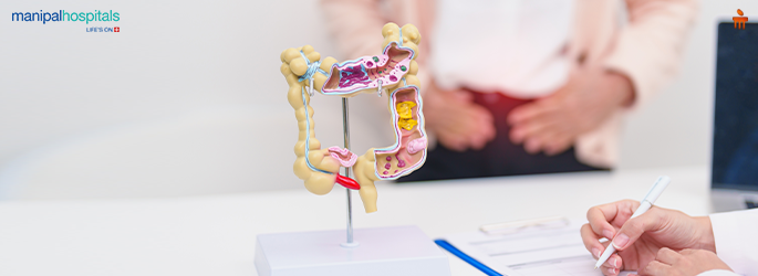 Ulcerative colitis symptoms causes and treatment