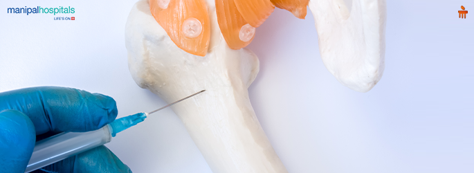 What Is a Bone Biopsy? Steps, Risks & Recovery