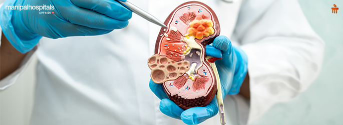 Learn about diabetic kidney disease, its early symptoms, stages, causes, and treatment options. Discover how to protect kidney health with diabetes.