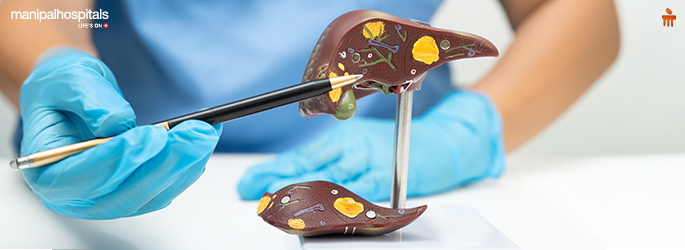 Fatty Liver Disease Explained by Experts