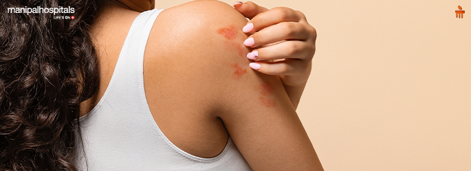 Understanding Fungal Infection: Common Forms, Risk Factors & Treatment Options