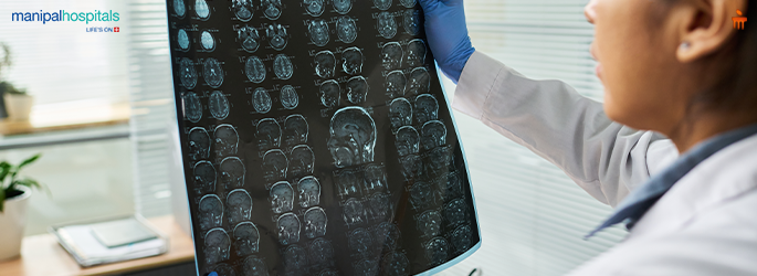 Neurological disorders symptoms and treatment