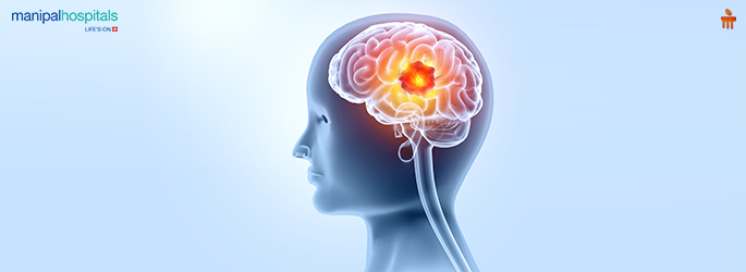 Understanding Brain Tumours: What You Need to Know