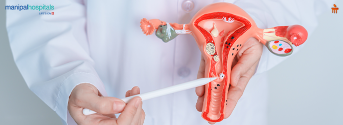 Fibroid health overview