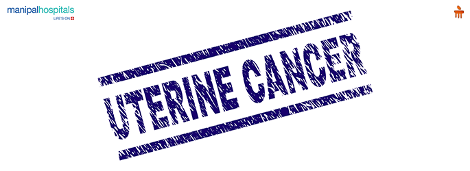 Uterine Cancer: 7 Alarming Signs You Shouldn’t Miss