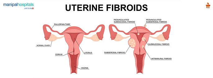 Epilepsy in Children: Signs, Diagnosis & Care