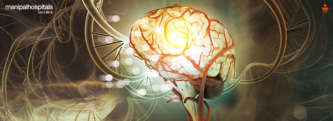 Deep Brain Stimulation Surgery: What to Expect