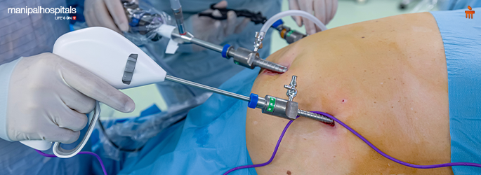 What Is Bariatric Surgery? Types, Benefits, and Risks Explained