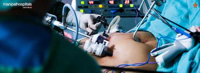 What Is Gastric Sleeve Surgery? Understanding the Operation, Recovery, and Long-Term Results
