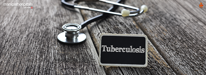 Tuberculosis: Causes, Symptoms & Types Explained