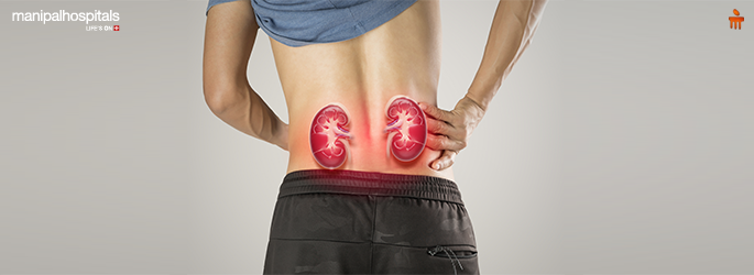 What Is a Kidney Biopsy? A Simple Guide for Patients