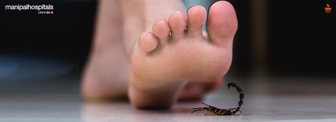 What to Do After a Scorpion Sting: Symptoms, First Aid, and Medical Treatment