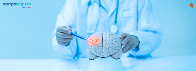 What is Hydrocephalus? Causes, Symptoms & Treatment Options Explained
