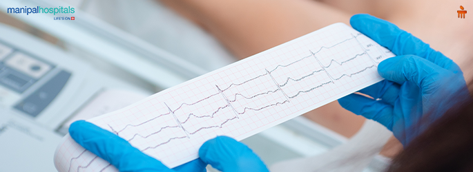 what-is-ecg-types-benefits