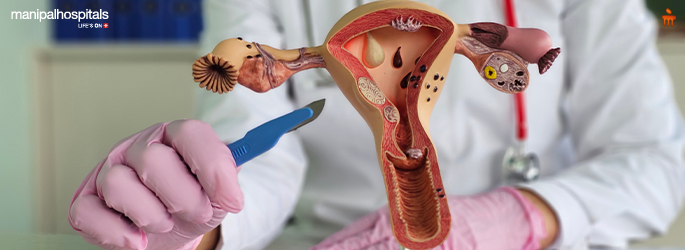 Minilaparotomy Myomectomy for Large Uterine Fibroids | Fibroid Surgery Guide