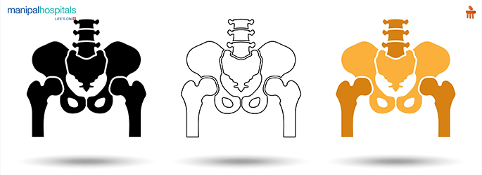 When Is It Time for a Hip Replacement? Signs You Shouldn’t Ignore
