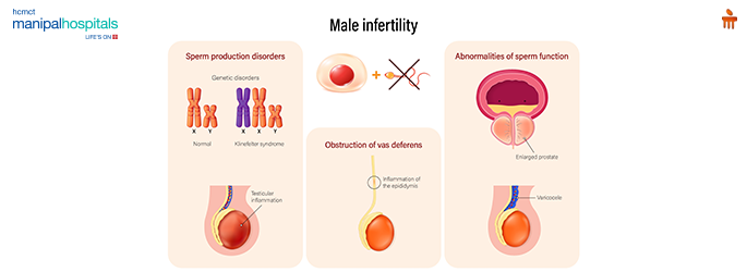 male infertility causes