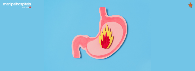 Why Do You Get Acid Reflux? Causes and Remedis 
