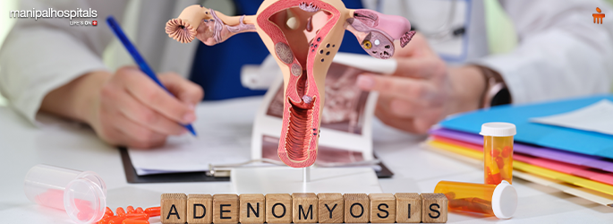 Can Adenomyosis Be Cured? Symptoms, Treatment & Diet Guide
