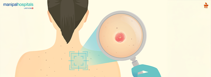 how to prevent skin cancer