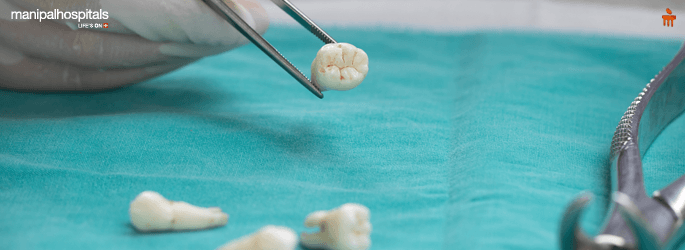 Best Dental Hospital in Bangalore