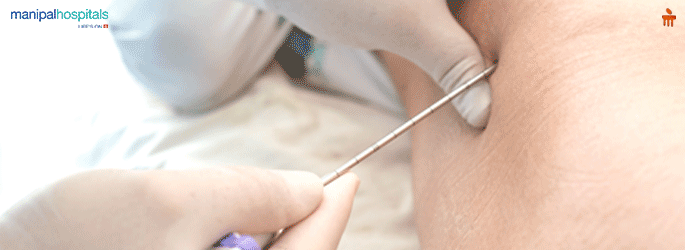 Bone Sarcoma Treatment in Goa