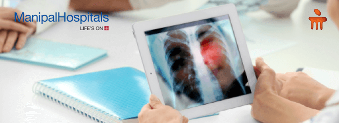 Best Lung Cancer Treatment Hospital in India